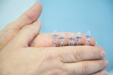 Újabb negatív rekord: meghalt 311 beteg Magyarországon