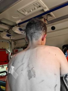 Tizenkilenc éves fiúra támadt a medve a székelyföldi Patakfalván