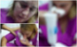 Feldühödött beteg törte össze a doktornő arcát 