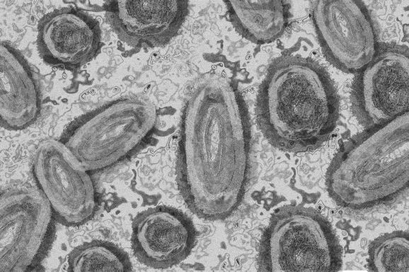 Két újabb majomhimlős esetet diagnosztizáltak Romániában