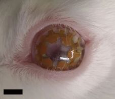 A tudósok okos kontaktlencsével kezelnék a glaukómát, a vakságot okozó szembetegséget