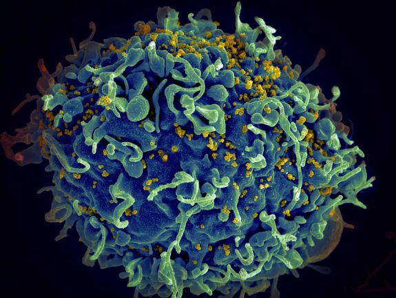 Heteroszexuális kapcsolatban fertőzőképesebb lehet a HIV, mint homoszexuálisban