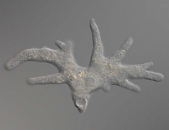 Agyevő amőba ölt meg egy kamasz fiút