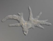 Agyevő amőba ölt meg egy kamasz fiút