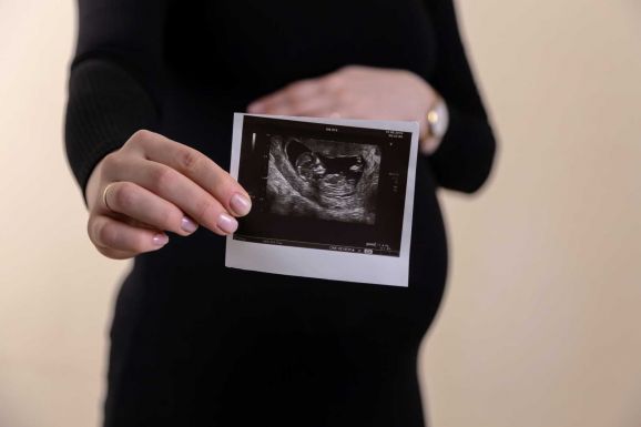 A magzatok is grimaszolnak a kelkáposzta ízére egy tanulmány szerint