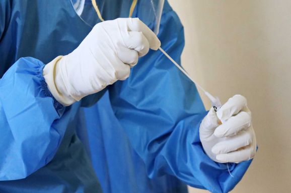 Kutatás: a long Covid is szedi áldozatait