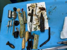 Még a kiskanalat is lenyelte a kórházba került férfi