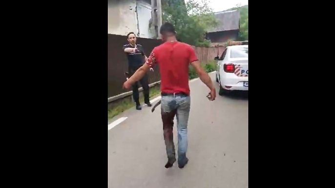 Kolozs megye: lábon lőttek a rendőrök egy fiatalt Bánffyhunyadon