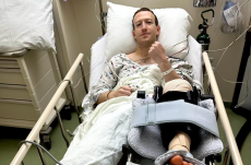 Kórházba került a Facebook-főnök