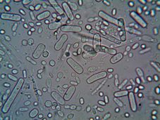 Közel negyven tudós tiltakozik: „Soha nem látott kockázatot jelentenek a földi életre” a tükörbaktériumok