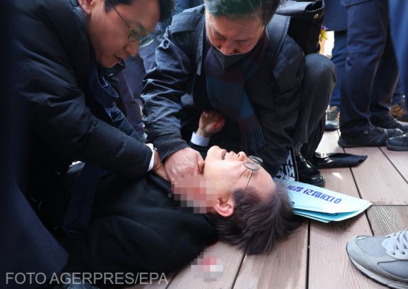 Nyakon szúrták az ellenzéki vezetőt