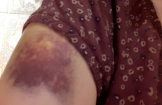 Elindítja a rágalmazási pert Parászka Boróka ellen a marosvásárhelyi rádiós