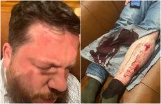 Megpróbálták eltenni láb alól Alekszej Navalnij korábbi közeli munkatársát