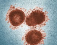 Meghalt egy 14 éves fiú Nipah-vírus okozta fertőzésben