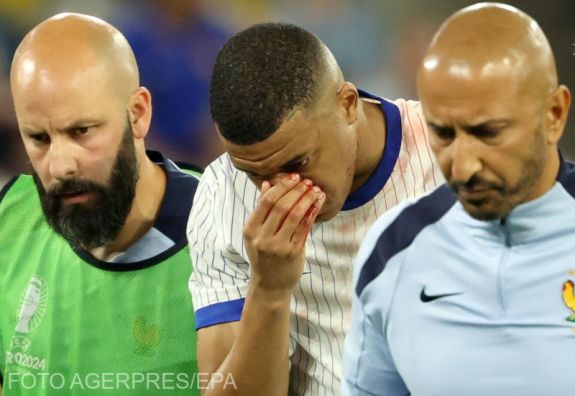 Foci Eb: Eltört Mbappé orra az osztrákok elleni mérkőzésen, öngóllal nyertek a franciák