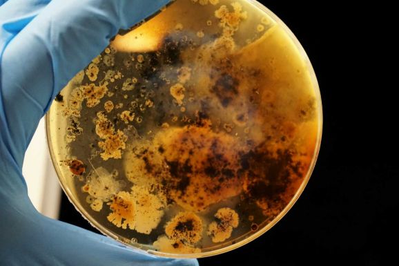 Magyar innováció: a sejtfalat szétroncsolva pusztítja el a baktériumokat az új antibiotikum