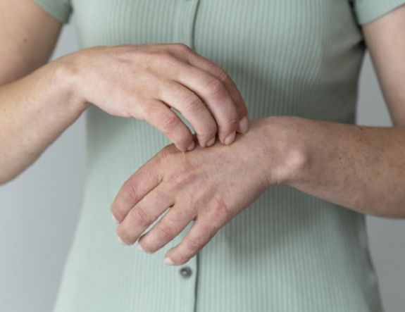 Kolozsvár: A második leprás megbetegedést is megerősítették