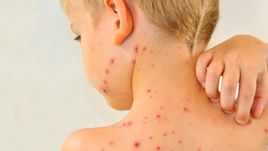 Súlyos átoltottsági válság Romániában: a gyerekek fele nem kapja meg időben a kanyaró elleni vakcinát