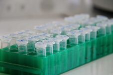 Tüdőpestistől tartanak Szibériában egy kutató halála után