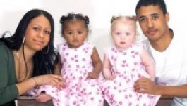 Ritka látvány: fehér-fekete ikerpáros