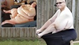 Lötyög a bőrében a 300 kilót fogyó brit férfi