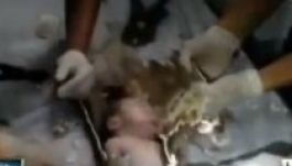 Lehúzták a vécén az újszülöttet, de nem halt meg