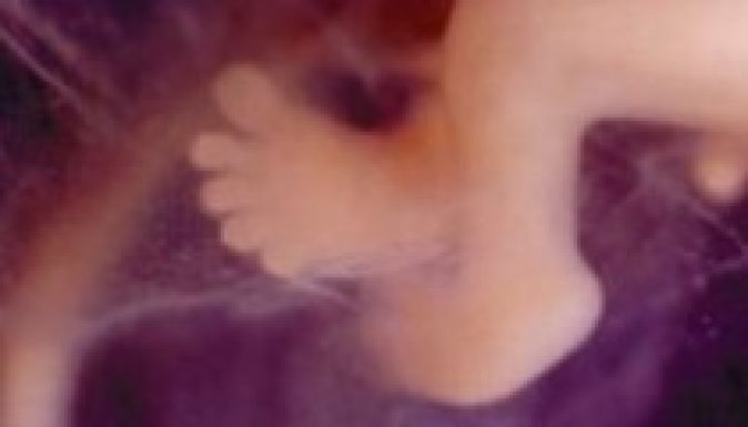 Elterjedt a 10-14 éves lányok körében az abortusz