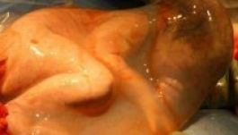 Burokban jött világra a kisbaba