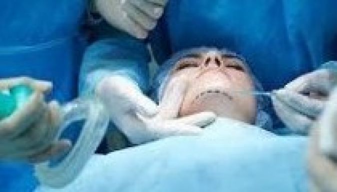 A fejátültetés sem lehetetlen már