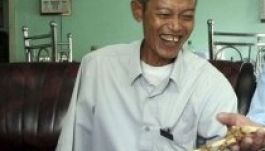 A megcsonkított örült 47 után visszakapott karjának