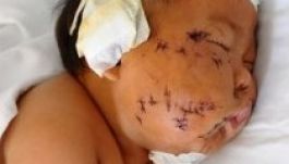 Összevagdosta a fiát, mert harapdálta a mellét