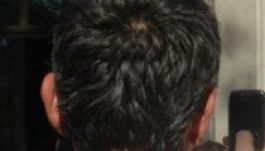 Dekonspiráljuk Ráduly Róbert polgármester „szekusát”