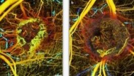 Ijesztő: így terjed a gyilkos kór a szervezetben