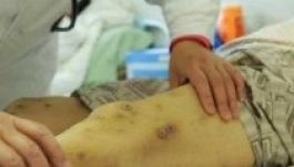 Rendületlenül gyilkolnak az ázsiai óriásdarazsak