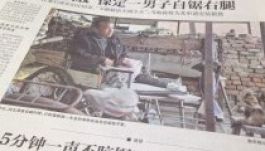 Saját kezűleg amputálta a lábát egy kínai férfi