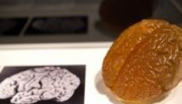 Tévedésből más agyát kutatták a híres matematikusé helyett