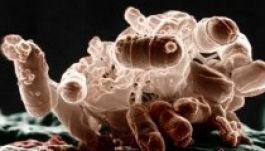 Ezeket az élőlényeket isszuk meg a csapvízzel együtt (GALÉRIA)