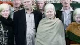 Indiában él a világ legnagyobb albínó családja