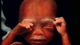 Így készül egy kisbaba – világhírnevet jelentő fotók (GALÉRIA)