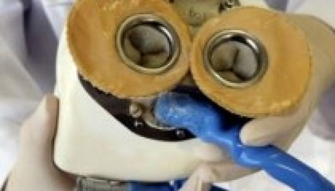 Először ültettek be egy teljes elektromos műszívet