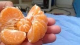 Jópofa narancsot fotóztak Törökországban