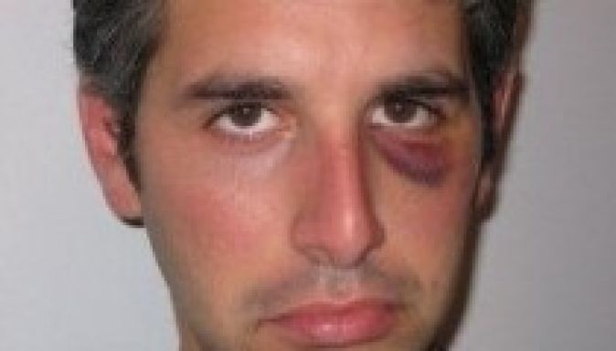 Megverte a panziós, mert nem akart manelét hallgatni szilveszterkor