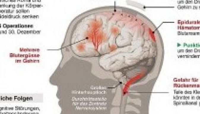 Élete végéig kómában tarthatják Michael Schumachert