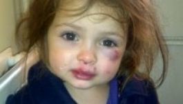 Aggasztóan nő a gyerekbántalmazások száma Romániában