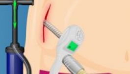 Betiltották a Plasztikai sebészet Barbie-nak nevű játékot