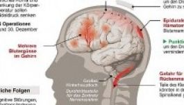 Élete végéig kómában tarthatják Michael Schumachert