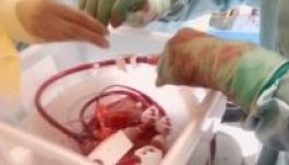 Két év szünet után újraindul a szívátültetés Marosvásárhelyen