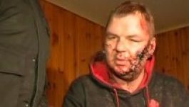 A megkínzott ukrán ellenzéki aktivistát az EU-ban kezelhetik