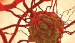 A rák világnapján az európai betegek jogairól tárgyal az EP