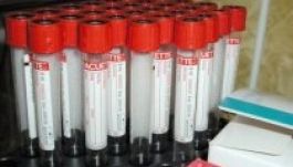 Több mint 38 millió lejjel egészítették ki a HIV-programot